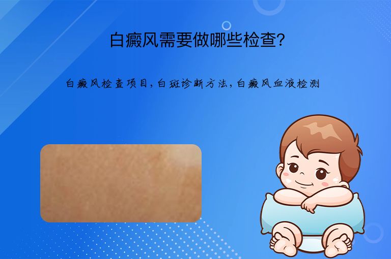白癜风需要做哪些检查？”
