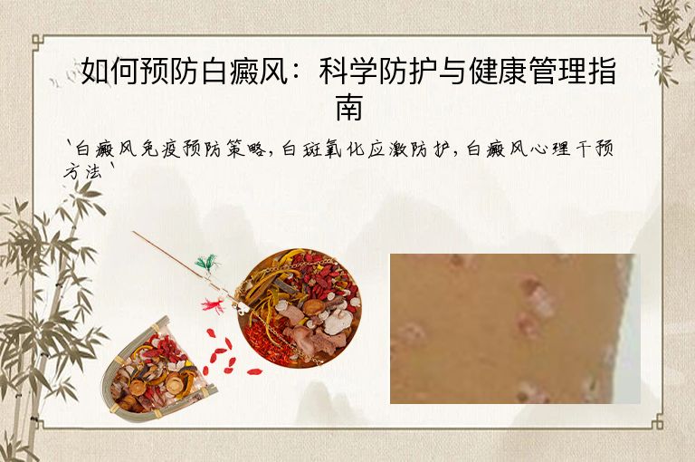 如何预防白癜风:科学防护与健康管理指南