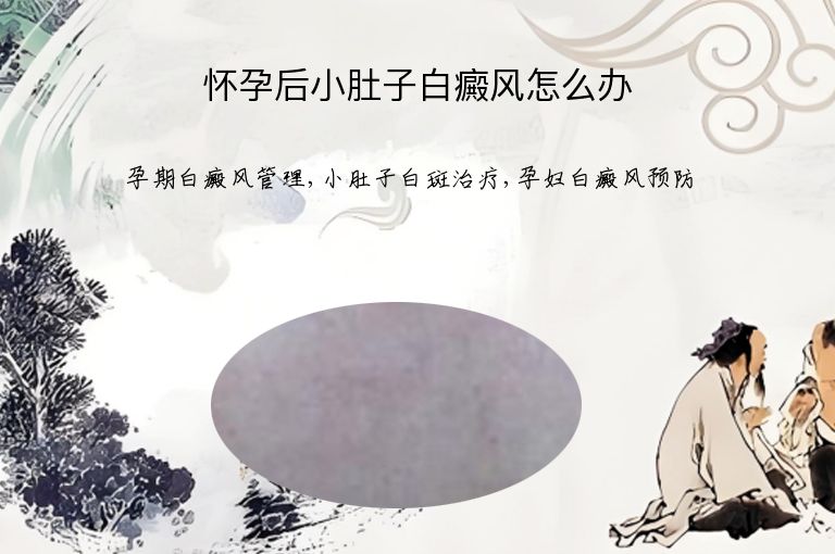 https://www.bdfsjzyy.com/d/file/p/919f33d7d5211a02e788222c4649dd78.jpeg
