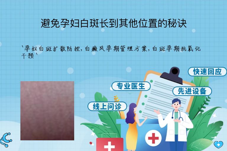 避免孕妇白斑长到其他位置的秘诀