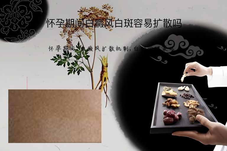 怀孕期间白癜风白斑容易扩散吗”