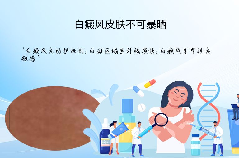 白癜风皮肤不可暴晒
