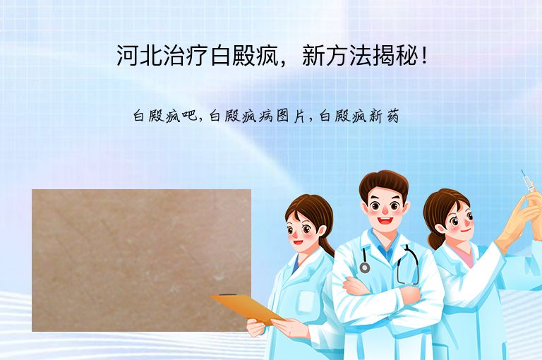 河北治疗白殿疯，新方法揭秘！”