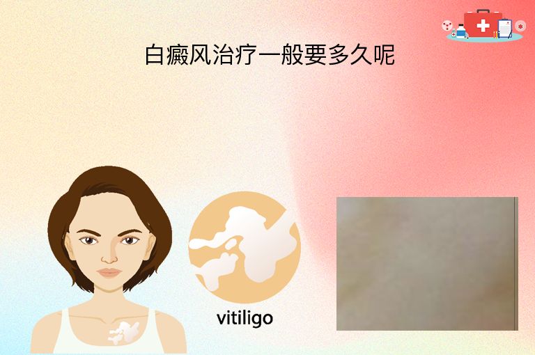 白癜风治疗一般要多久呢”