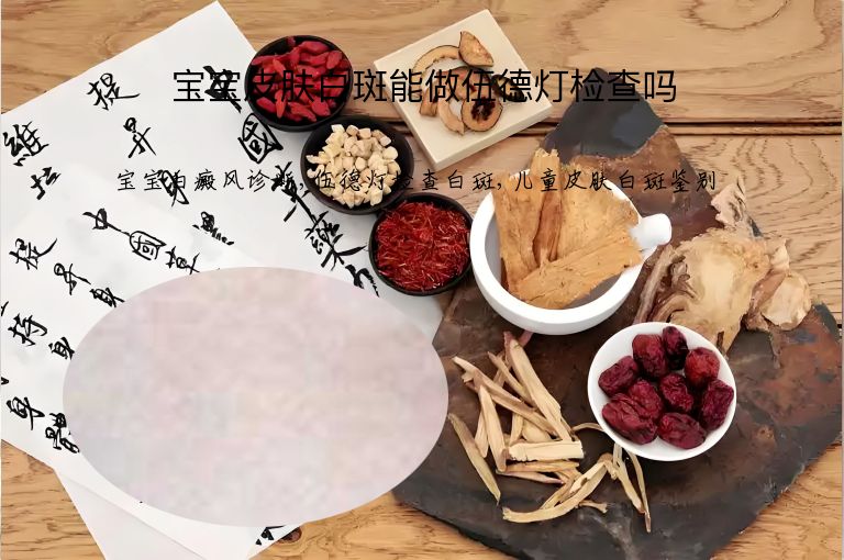 宝宝皮肤白斑能做伍德灯检查吗”