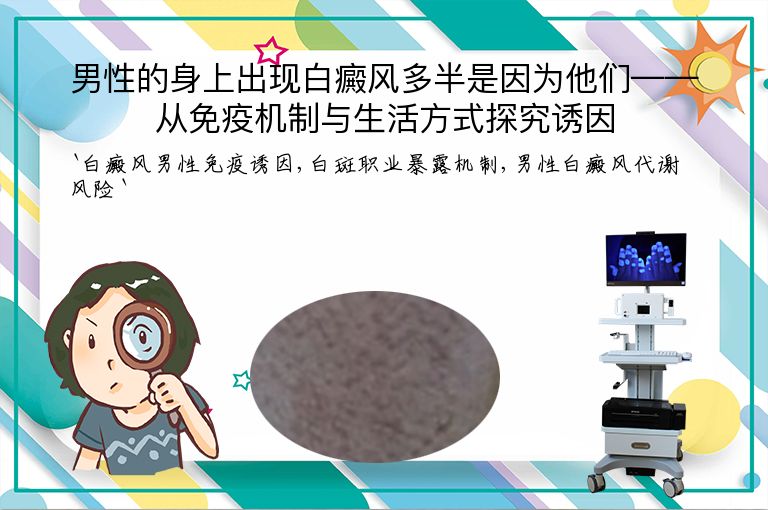 男性的身上出现白癜风多半是因为他们——从免疫机制与生活方式探究诱因