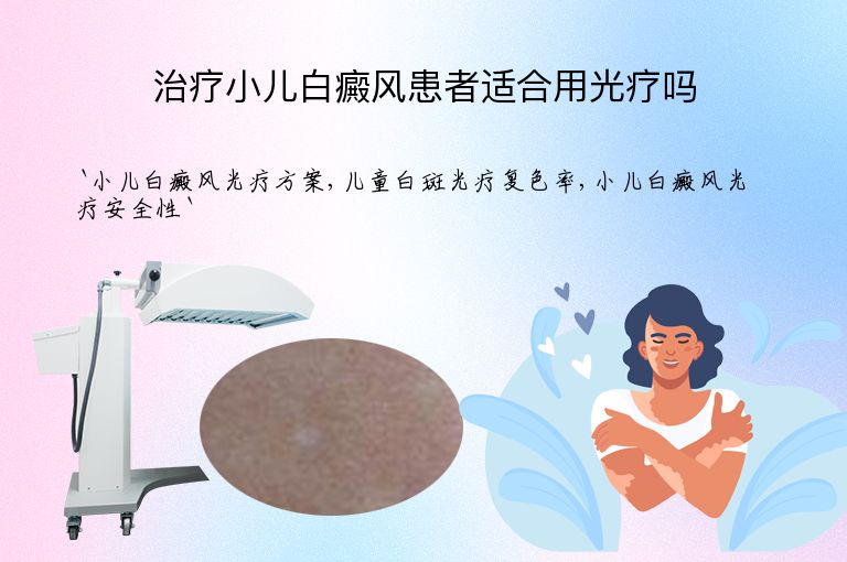 治疗小儿白癜风患者适合用光疗吗