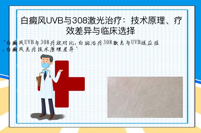 白癜风UVB与308激光治疗：技术原理、疗效差异与临床选择”