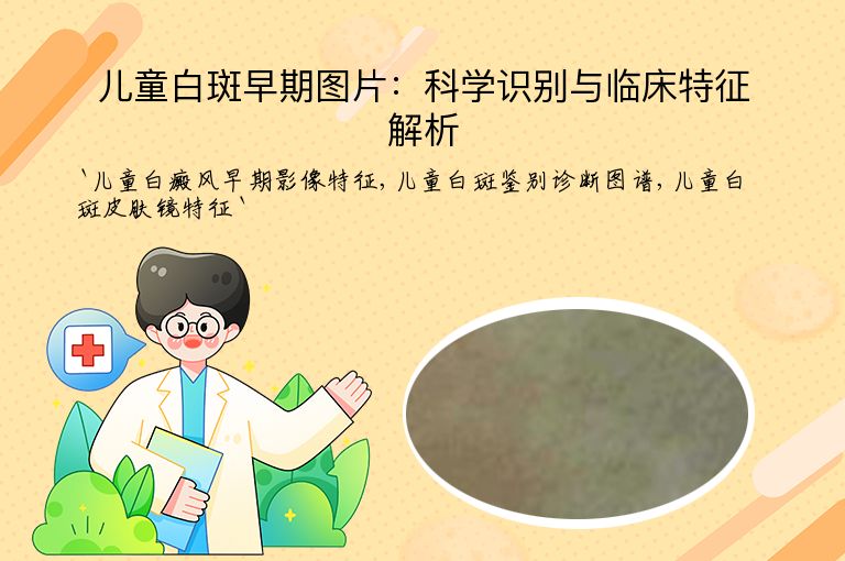 儿童白斑早期图片:科学识别与临床特征解析