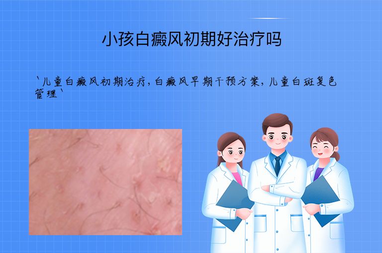 小孩白癜风初期好治疗吗
