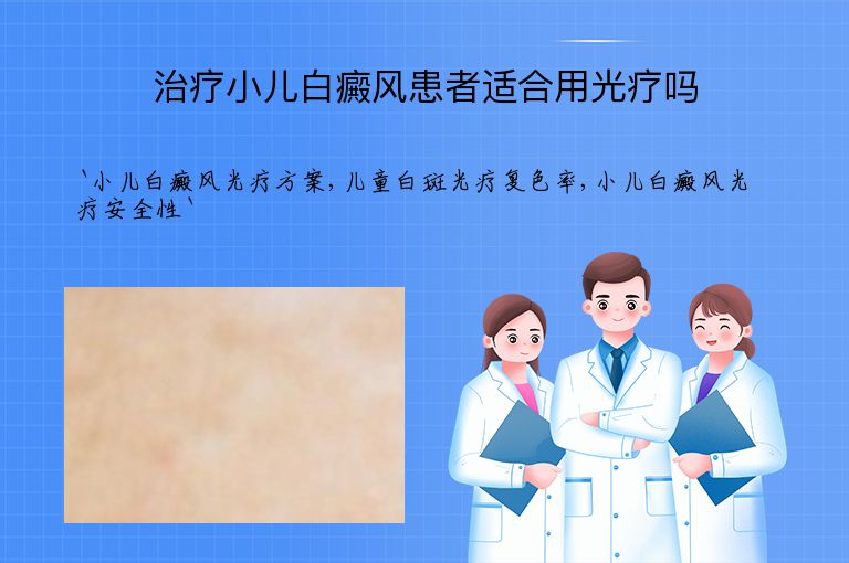 治疗小儿白癜风患者适合用光疗吗