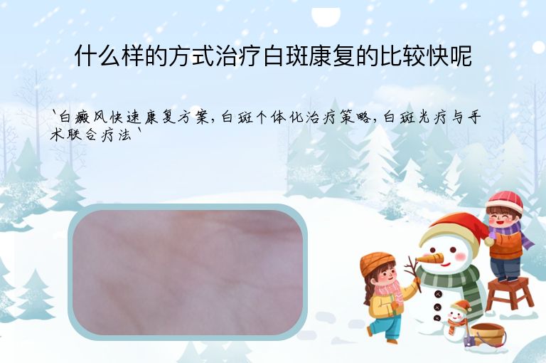 什么样的方式治疗白斑康复的比较快呢