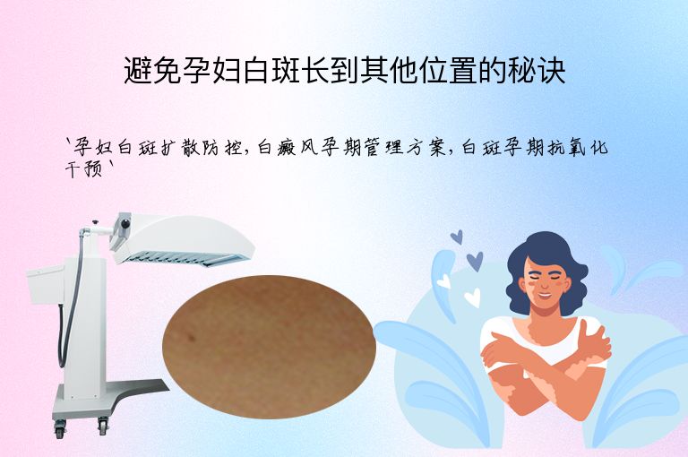 避免孕妇白斑长到其他位置的秘诀