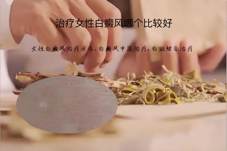 治疗女性白癜风哪个比较好”