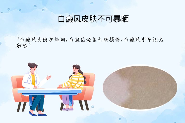 白癜风皮肤不可暴晒