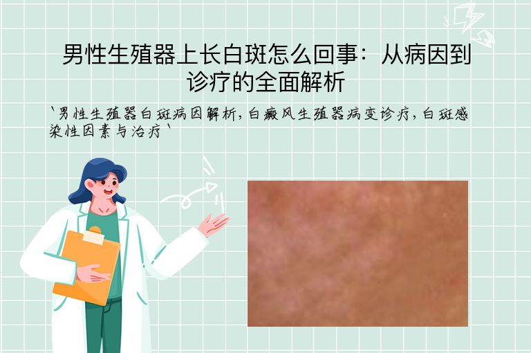 男性生殖器上长白斑怎么回事：从病因到诊疗的全面解析