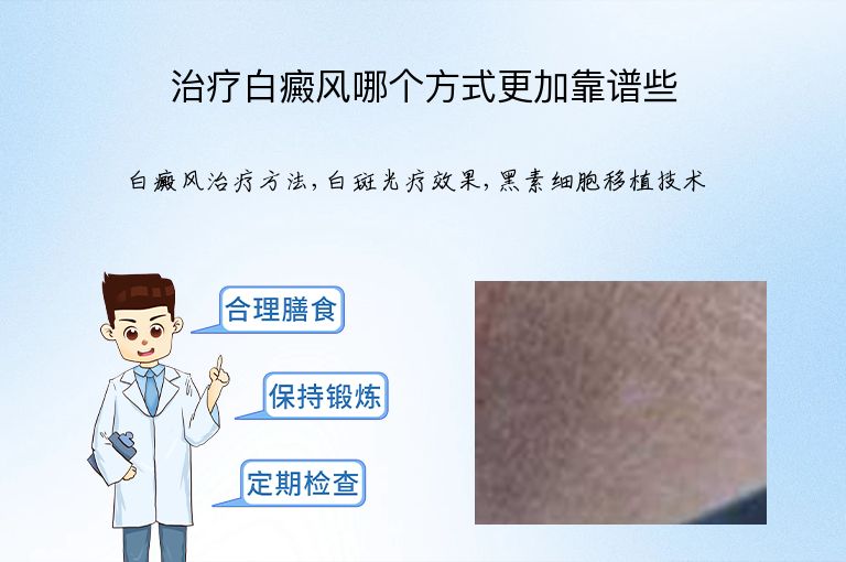https://www.bdfsjzyy.com/d/file/p/1fc1e94a9aa1eb7e555bfb583e7d4170.jpeg