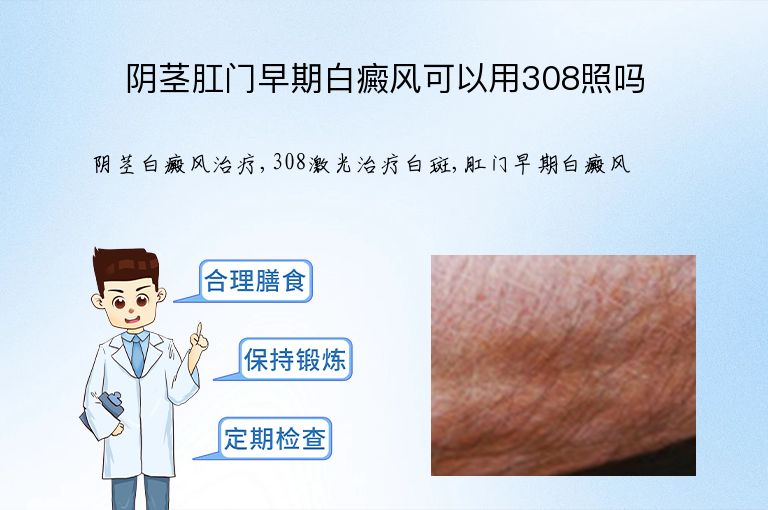 https://www.bdfsjzyy.com/d/file/p/240e1796abe5f7ea5ae84125647d41b4.jpeg