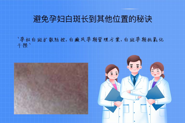 避免孕妇白斑长到其他位置的秘诀