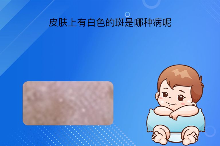 皮肤上有白色的斑是哪种病呢