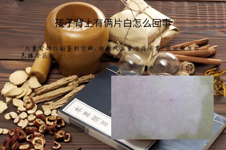 孩子背上有俩片白怎么回事