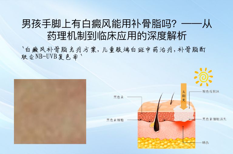 男孩手脚上有白癜风能用补骨脂吗？——从药理机制到临床应用的深度解析