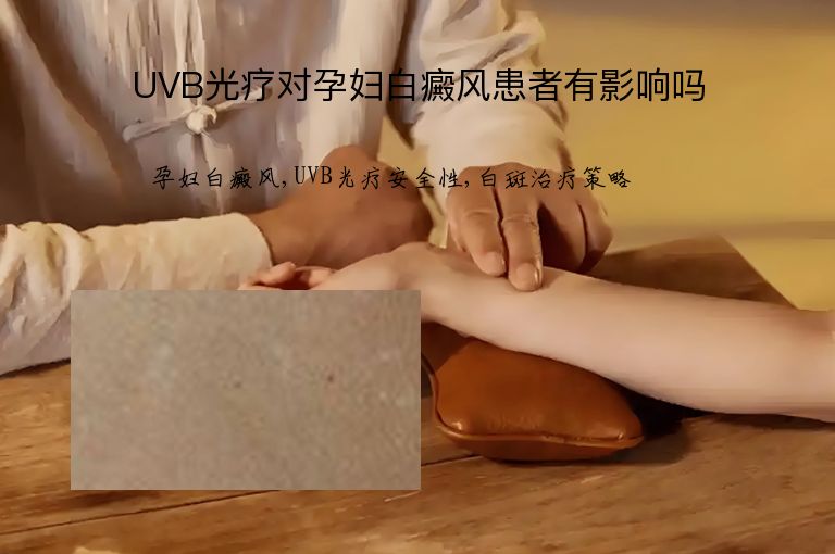 UVB光疗对孕妇白癜风患者有影响吗”
