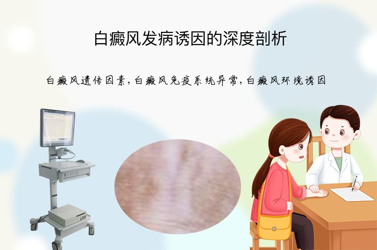 白癜风发病诱因的深度剖析”