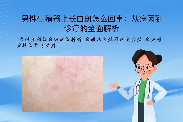 男性生殖器上长白斑怎么回事：从病因到诊疗的全面解析