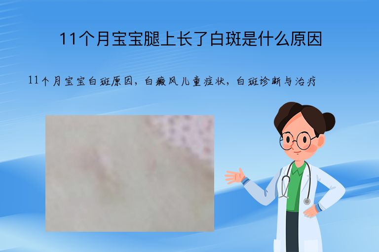 11个月宝宝腿上长了白斑是什么原因”