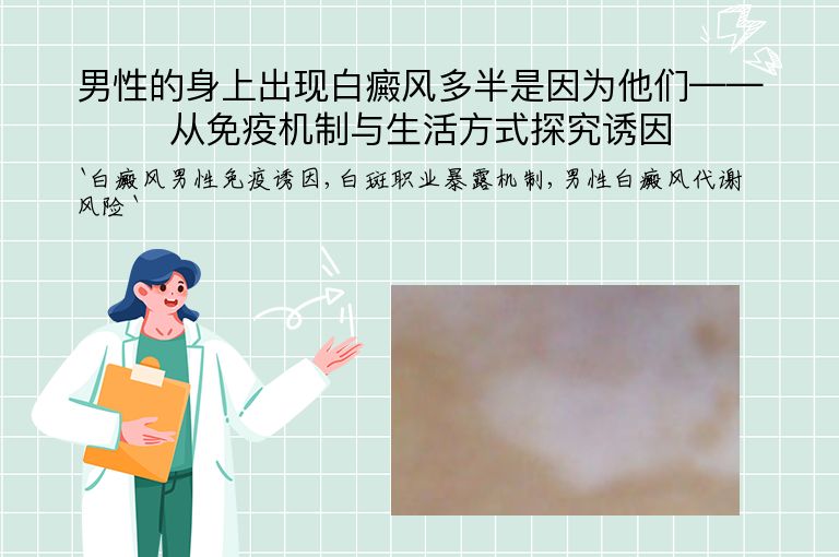 男性的身上出现白癜风多半是因为他们——从免疫机制与生活方式探究诱因