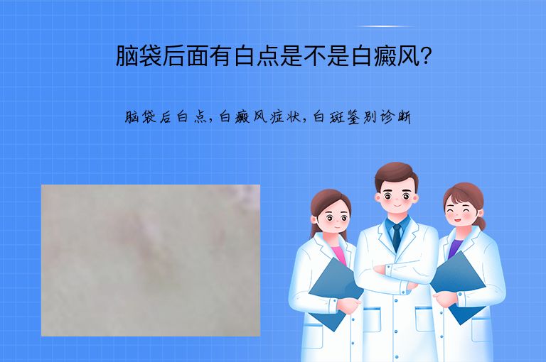 脑袋后面有白点是不是白癜风?”