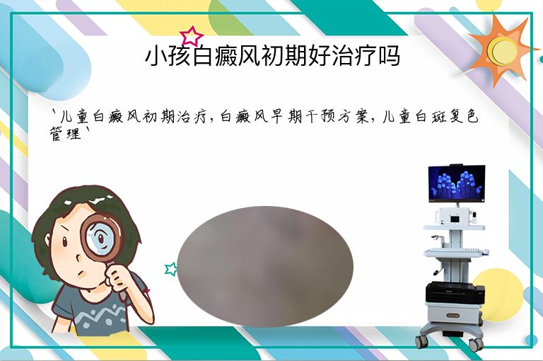 小孩白癜风初期好治疗吗