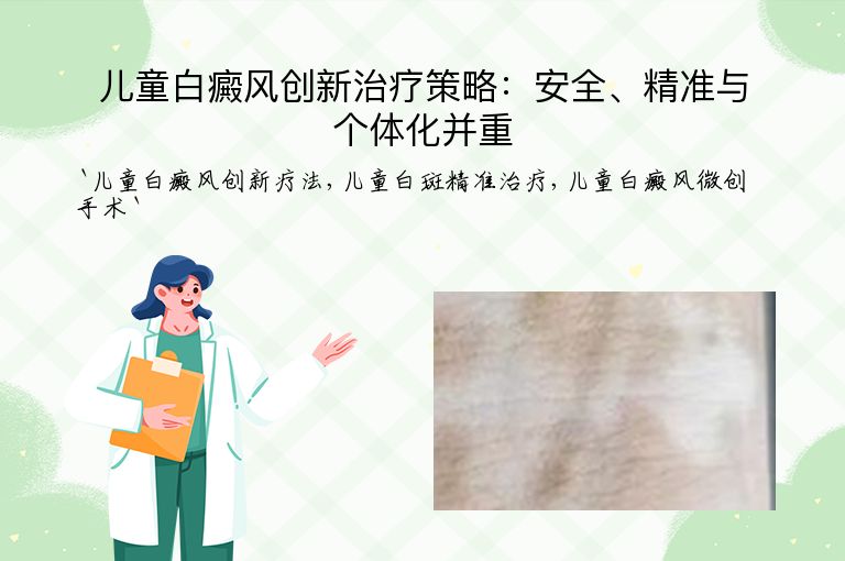 儿童白癜风创新治疗策略:安全、精准与个体化并重