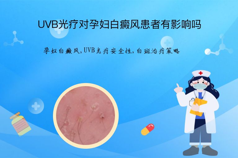 UVB光疗对孕妇白癜风患者有影响吗”