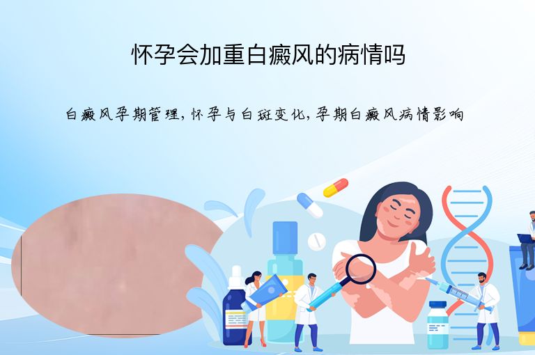 怀孕会加重白癜风的病情吗”