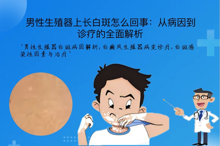 男性生殖器上长白斑怎么回事:从病因到诊疗的全面解析