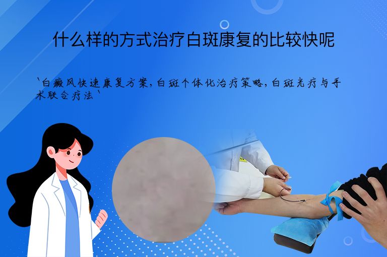 什么样的方式治疗白斑康复的比较快呢