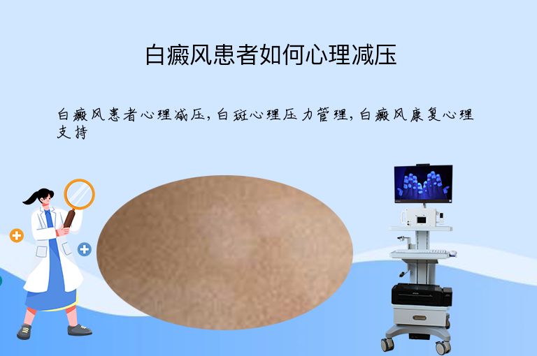 白癜风患者如何心理减压”