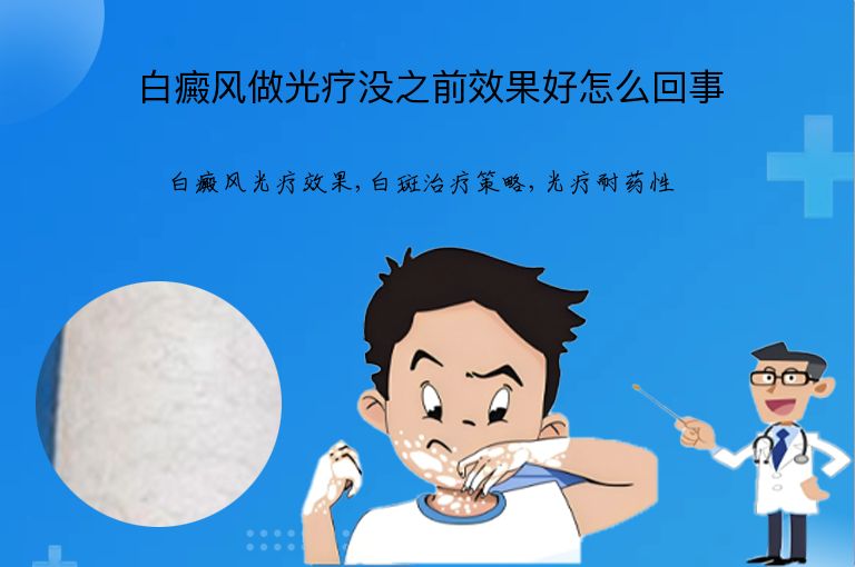白癜风做光疗没之前效果好怎么回事”