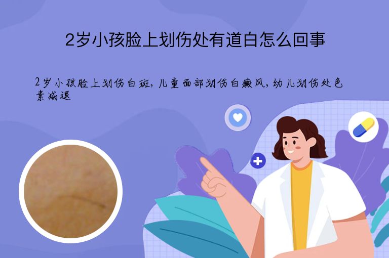2岁小孩脸上划伤处有道白怎么回事”