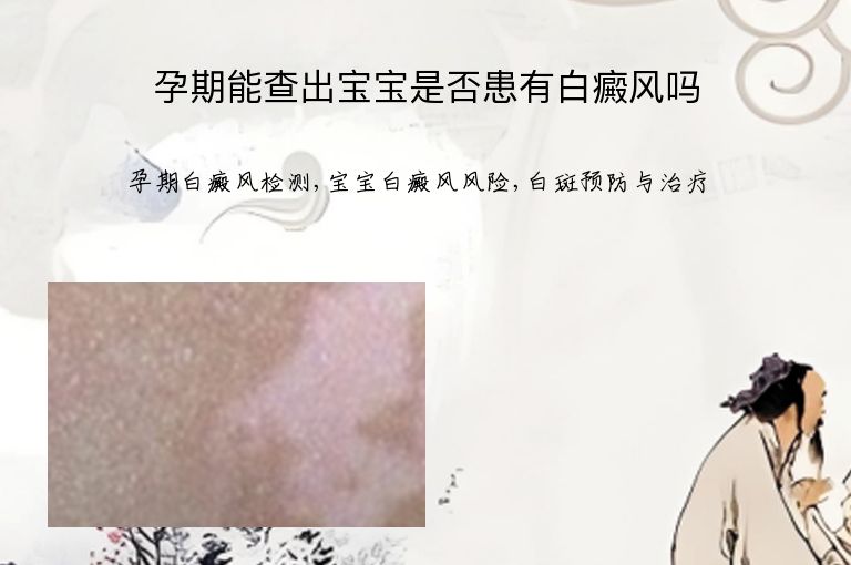 https://www.bdfsjzyy.com/d/file/p/15af9d75711e61359d5cfd7bceed520c.jpeg