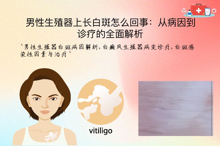男性生殖器上长白斑怎么回事：从病因到诊疗的全面解析