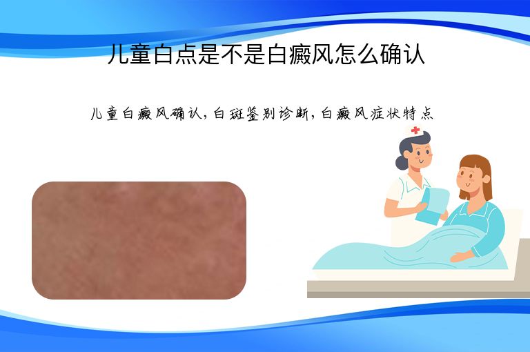 儿童白点是不是白癜风怎么确认”
