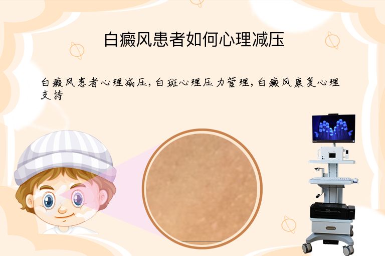 白癜风患者如何心理减压”