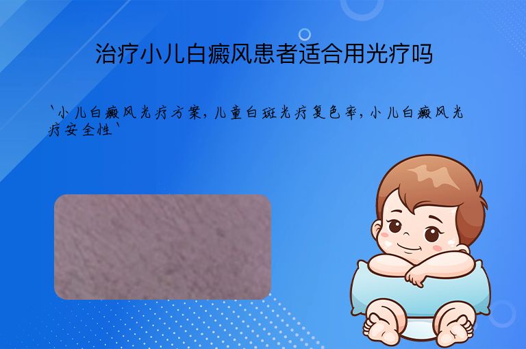 治疗小儿白癜风患者适合用光疗吗