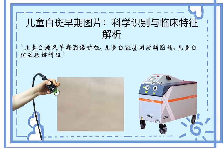 儿童白斑早期图片:科学识别与临床特征解析