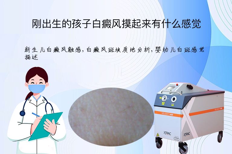 刚出生的孩子白癜风摸起来有什么感觉”