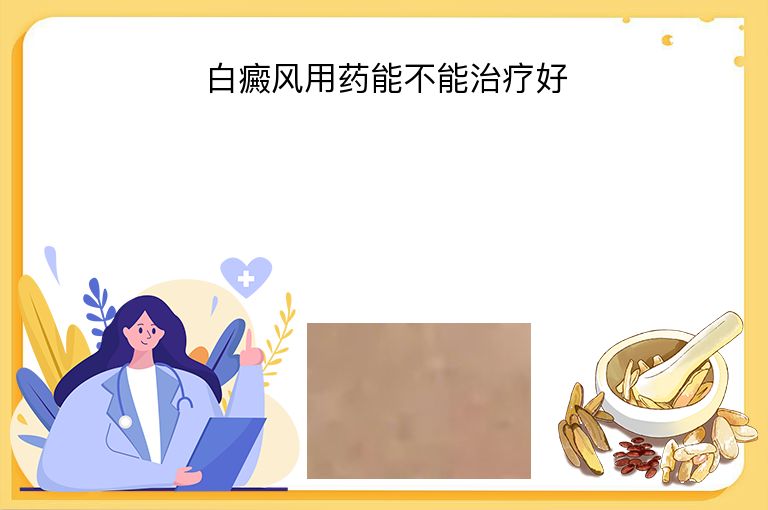 https://www.bdfsjzyy.com/d/file/p/145c22c3e7547ca15cd0d0ccd8a4b3bd.jpeg