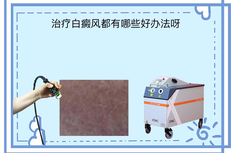 治疗白癜风都有哪些好办法呀”